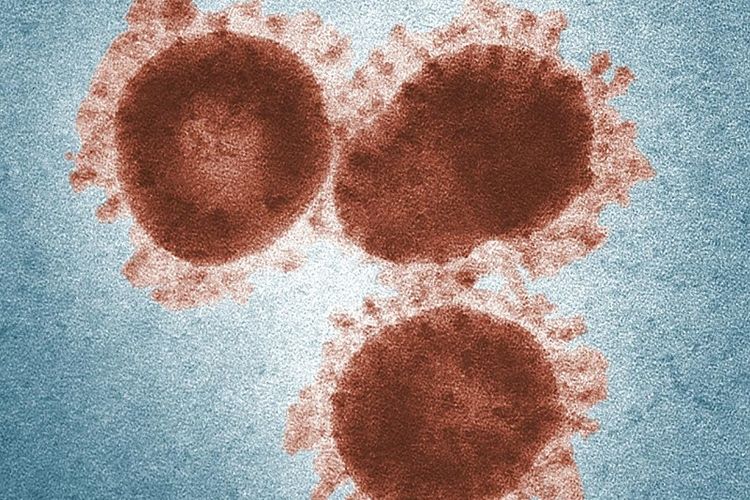 Kenali Gejala dan Faktor Penyebab HIV AIDS, Diketahui Ratusan Mahasiswa di Kota Bandung Terinfeksi HIV AIDS