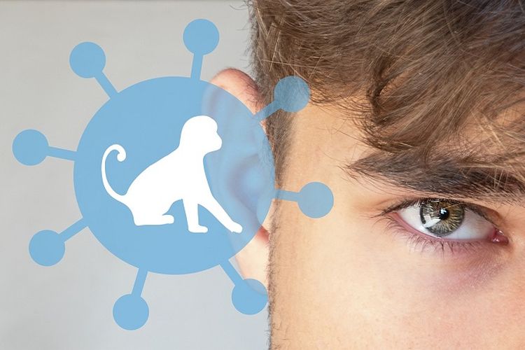 IDI Bentuk Satgas Cacar Monyet, Monkeypox Mulai Merangsek ke Indonesia.