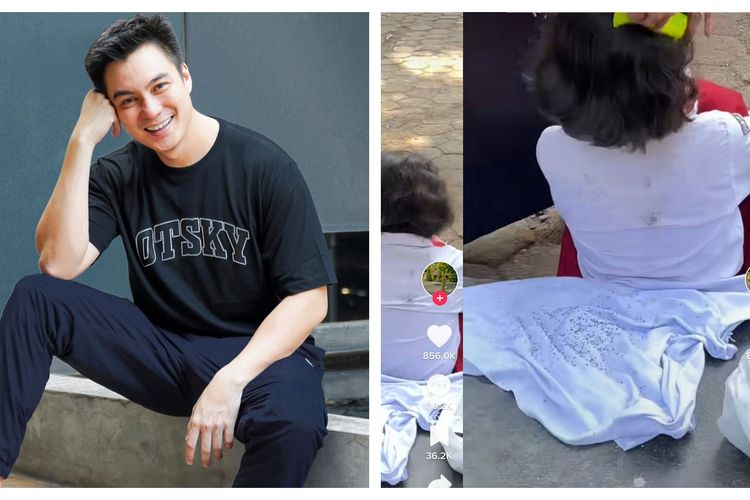 Baim Wong Tergerak Hatinya Bantu Anak SD yang Kutuan: Jangan Jadi Jijik