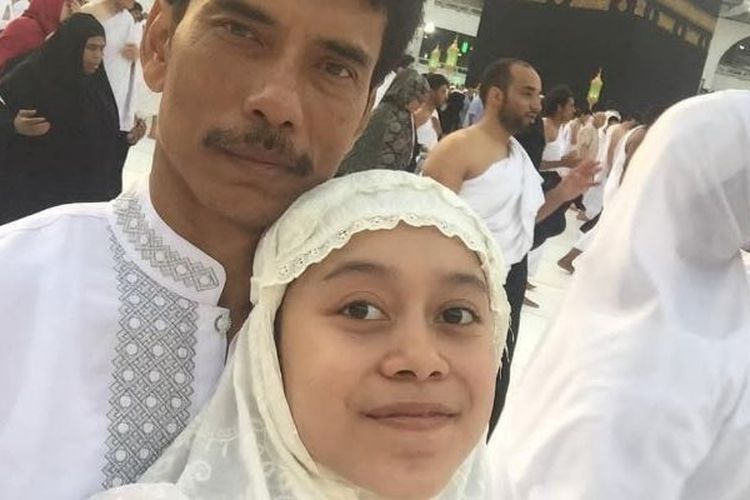 Bukan Karena Tercekik, Rusaknya Pita Suara Lesti Kejora Terjadi Karena Hal Ini, Berikut Penjelasan Dokter