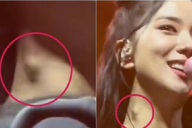 Viral Ada Benjolan di Leher Jisoo BLACKPINK, YG Entertainment Buka Suara, Begini Kondisi Kesehatan Terbarunya