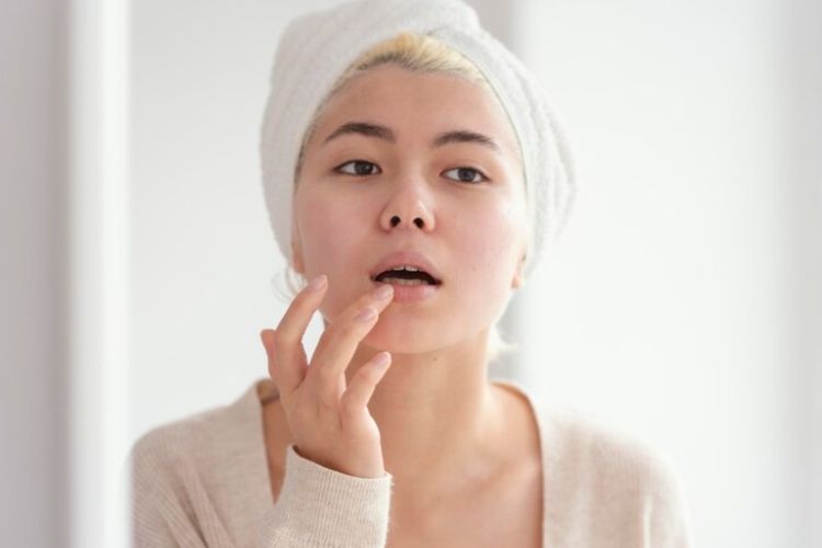 Kenali 6 Penyebab Bibir Hitam Padahal Tidak Merokok, Nomor 5 Sering Dilakukan Tanpa Disadari!