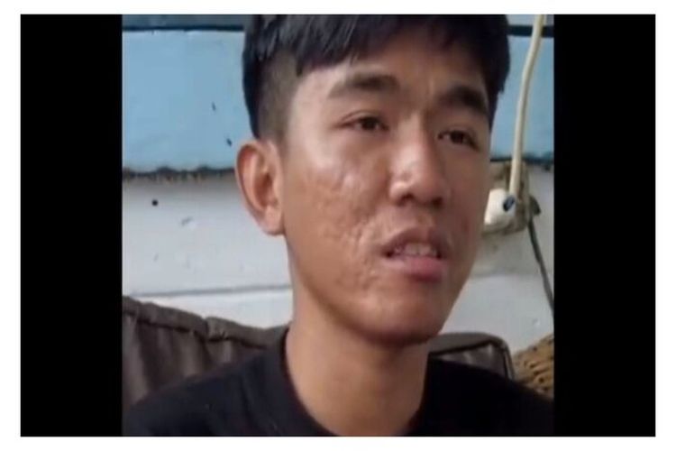 Tiko Tidak Bisa Jenguk Ibu Eny di Rumah Sakit Jiwa: Nanti Penanganan di Sana Gimana? Obat yang Dikasih Apa?