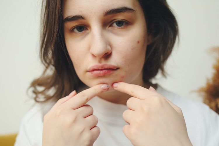 Jangan Sekali-kali Eksfoliasi dengan Cara Seperti Ini, Bisa Buat Kulit Terserang Penyakit Serius