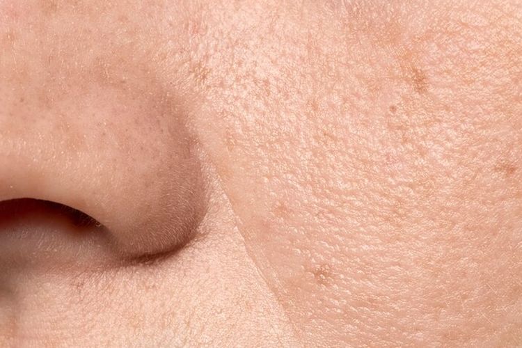 Awas! Untuk Pemula, Jangan Pakai 6 Kandungan Skincare Ini Secara Bersamaan, Bikin Iritasi dan Bruntusan