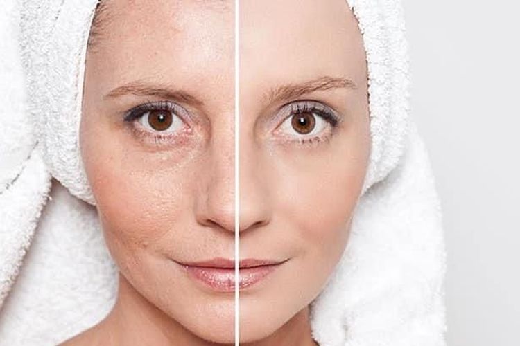 Cara Ampuh Menghilangkan Kerutan Di Wajah Menggunakan Minyak Kelapa, Berikut Cara Pembuatannya