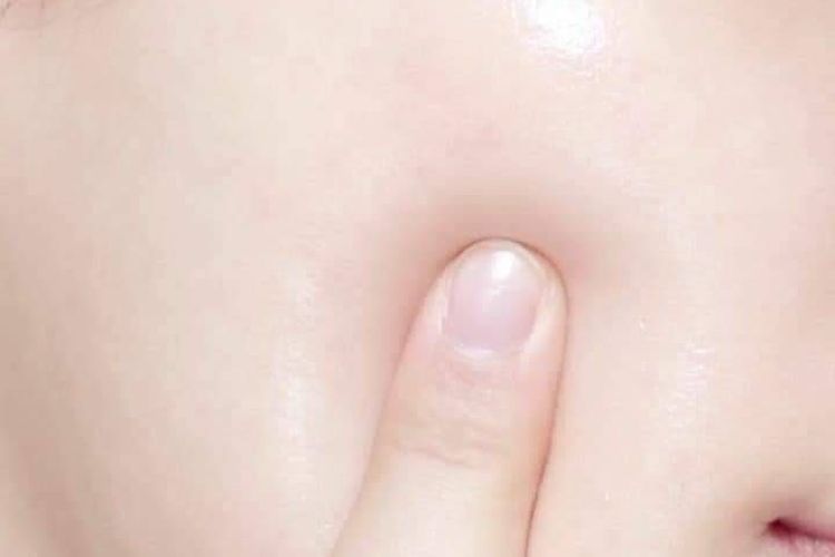 Kulit Anda Kering? Ini Solusi untuk Mengatasi Lengkap dengan Jenis-jenis Kulit Manusia