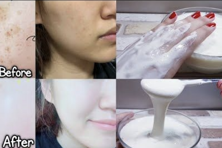 Wow! Ternyata Susu Dancow dan Putih Telur Bisa Jadi Masker Alami untuk Putihkan Wajah, Auto Glowing
