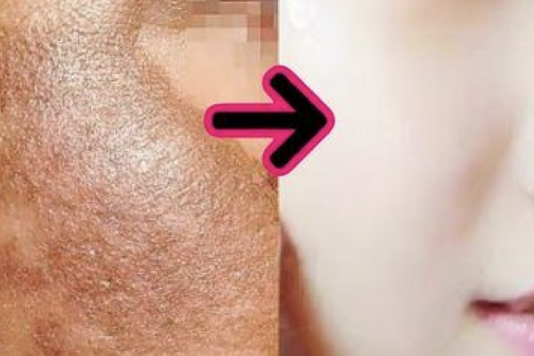 Cara Ampuh Agar Glowing Dalam Seminggu Dengan Bahan Alami dan Low Budget, Wajib Banget Buat Dicoba!