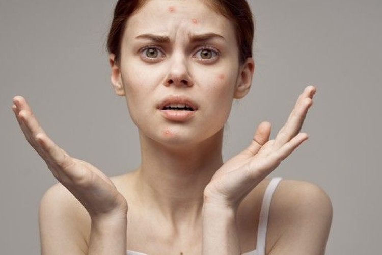 Ternyata Kesalahan Memakai Serum dapat Merusak Kulit, Ini Tutorial agar Hasilnya Sempurna