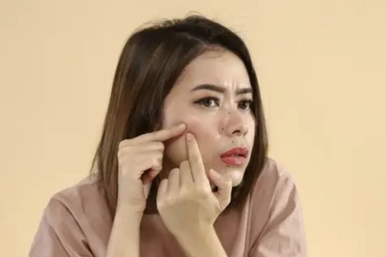 Stop Pakai Krim Abal-Abal, Berikut Tanda-Tanda Kerusakan pada Wajah Karena Penggunaan Krim Merkuri