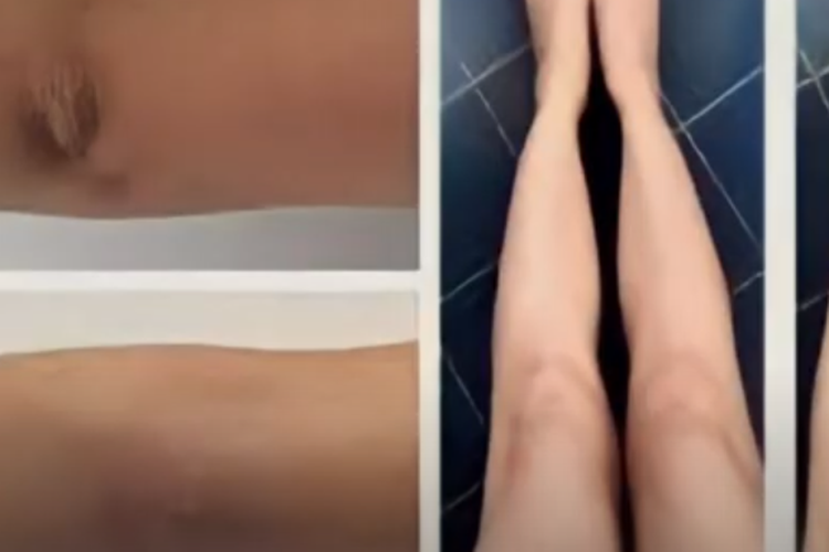 Wow Cukup dengan Bahan Ini Bisa Bikin Lutut Kamu Auto Jadi Putih , Buruan Coba!