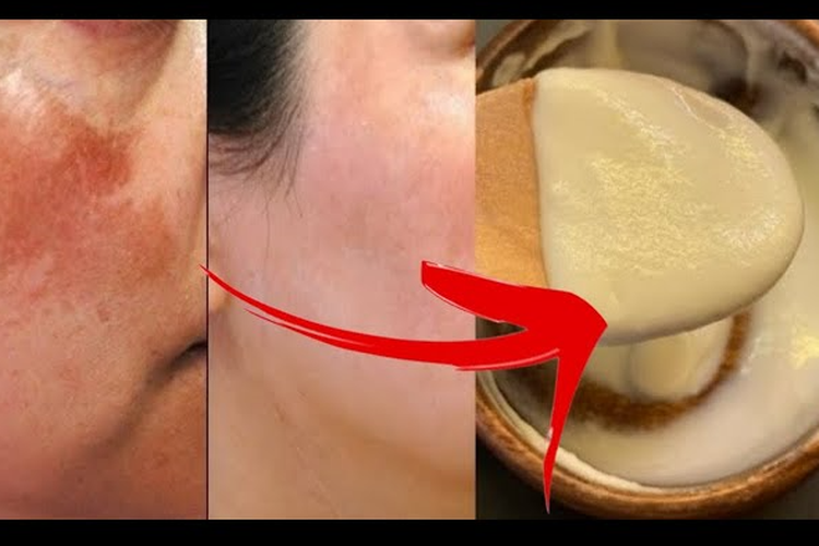 Cara Terlihat Muda secara Alami: Keriput dan Kendur Hilang dengan Olesan Bubuk Kopi dan Santan