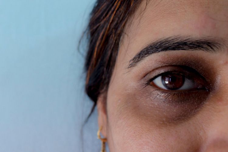 Muncul Lingkar Hitam di Mata Gegara Ngedrakor Semalaman? Buruan Atasi Pakai Masker Alami Ini