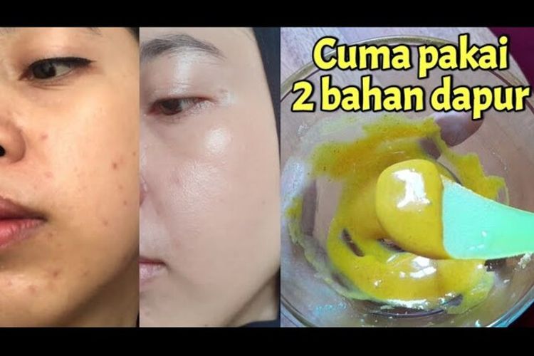 Tak Disangka, Pakai Masker Susu Dancow Dicampur Bubuk Kunyit Buat Wajah Glowing Cepat dan Putih Mulus