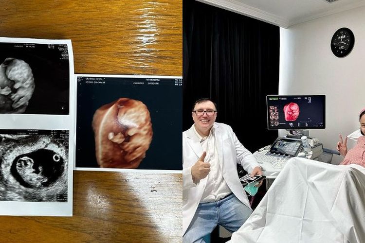 Tolak Pakai BPJS, Denise Chariesta Beberkan Alasan Open Donasi untuk Biaya Kelahirannya, Ternyata…