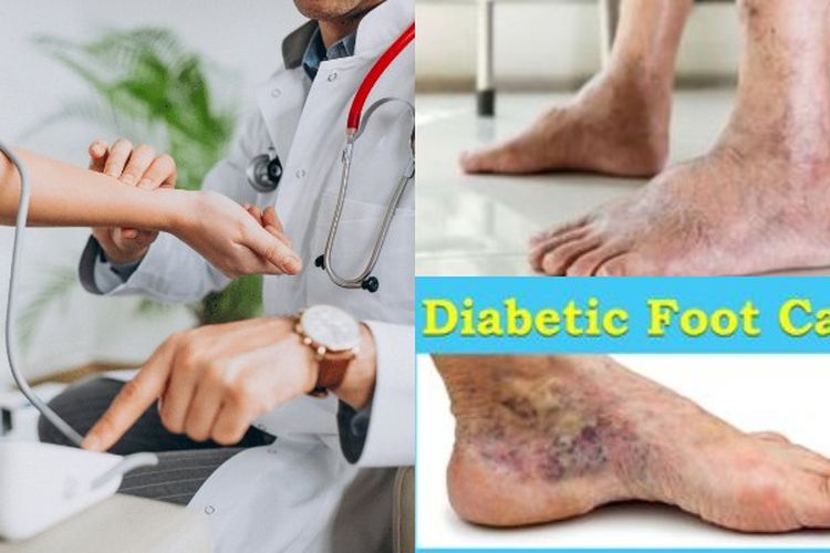 Kenali Diabetes Melitus Tipe 1 dan Tipe 2: Perbedaan, Gejala, dan Cara Penanganannya yang Tepat