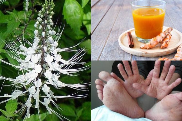 Ajaib! Jamu Kumis Kucing Bisa Jadi Penangkal Diabetes Melitus, Kadar Gula Darah Auto Normal dalam Waktu 7 Hari