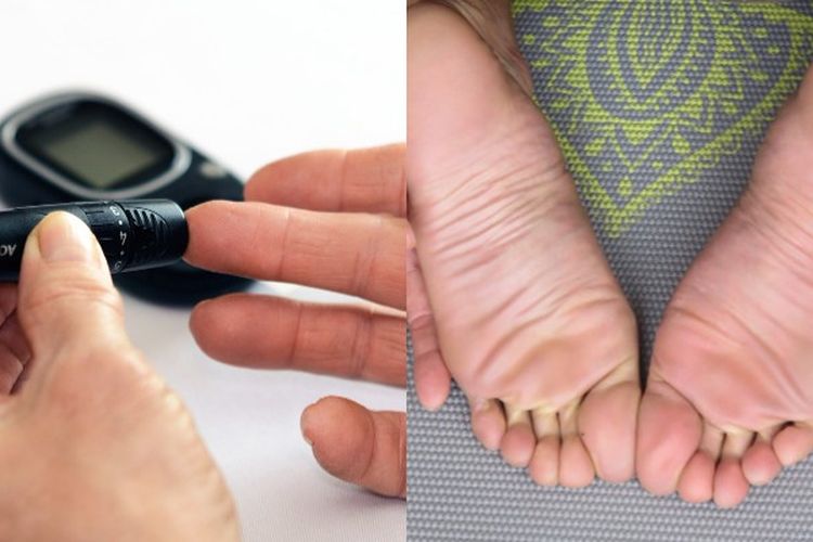 Wajib Disimak! Ini Penyebab Kadar Gula Drop Bagi Penderita Diabetes Melitus Sebelum Terlambat