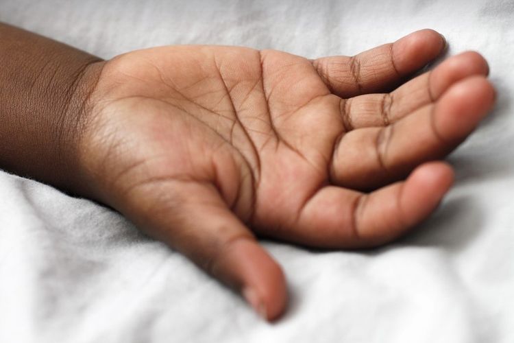 6 Tanda Gula Darah Tinggi Dilihat dari Kondisi Kulitnya, Banyak Penderita Diabetes Tak  Menyadarinya