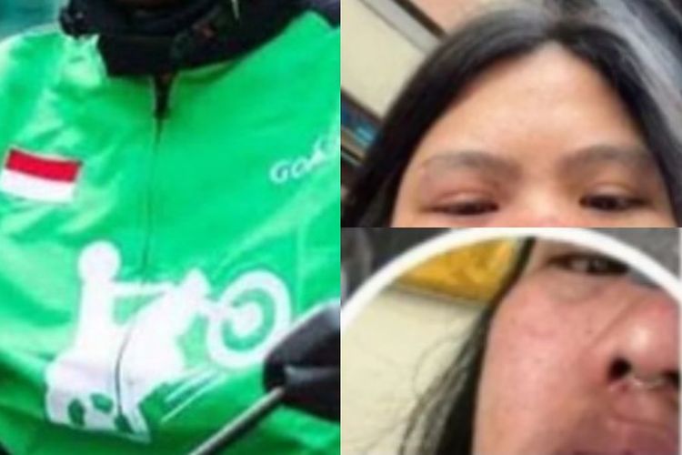 Diajak Ngobrol Tak Menyahut, Ojol Aniaya Penumpang Wanita di Bali Hingga Wajah Korban Babak Belur