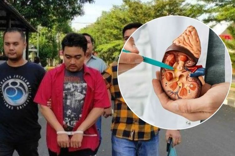 Berhasil Diamankan, Pria Asal Kudus Hendak Jual Ginjal ke India Seharga Rp175 Juta, Mau Buat Apa?