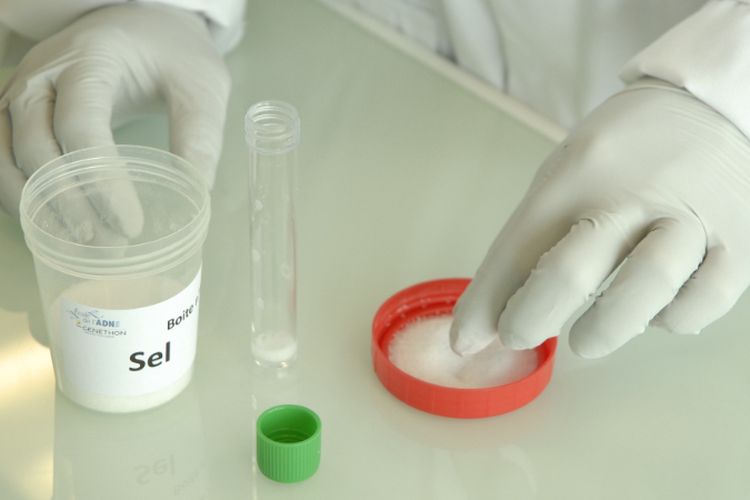 Identik Kasus Jessica Wongso, Inilah Gejala yang Dirasakan Orang saat Keracunan Sianida