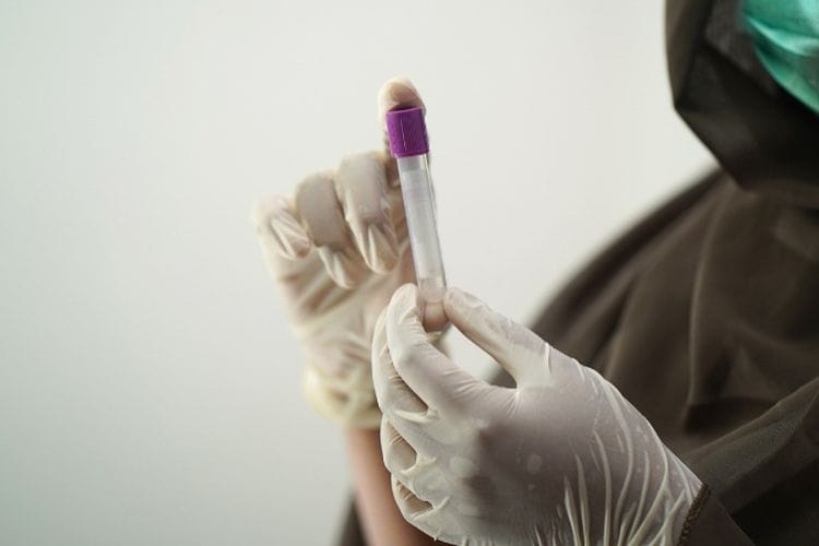 Korea Selatan Investasi Rp3,7 Triliun, Karawang Bakal Punya Pabrik Fraksionasi Plasma Pertama di Asia Tenggara