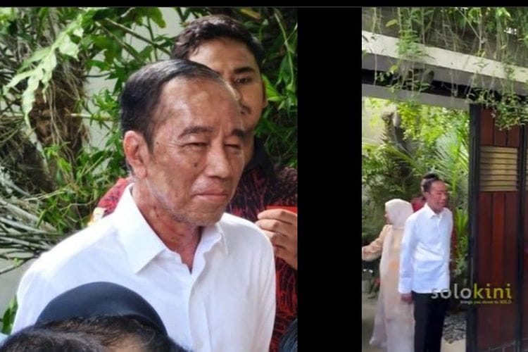Khawatir Jokowi Sakit Langka, Dokter Tifa: Pasti Gatal Sekali Rasanya Sekujur Tubuh